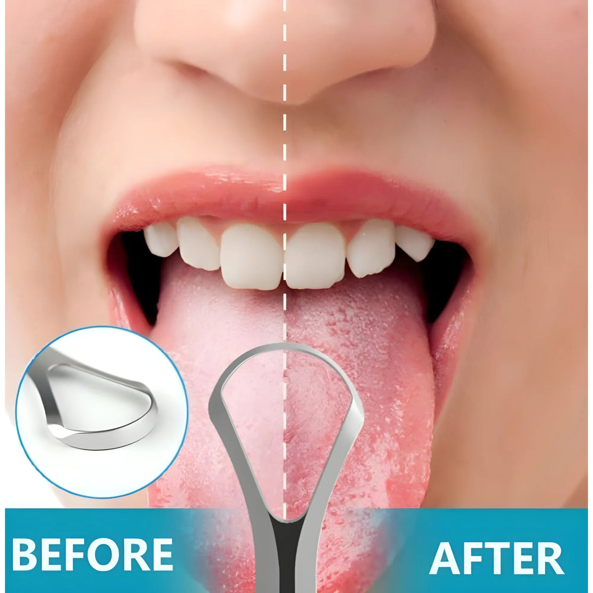 Pack of 2 Stainless Steel Tongue Scraper (Silver)