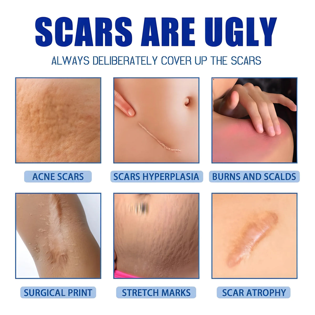 Plastic Scar Removal Cream (White-Blue)
